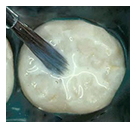 Sealants