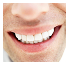 Whitening