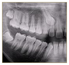 X-Rays